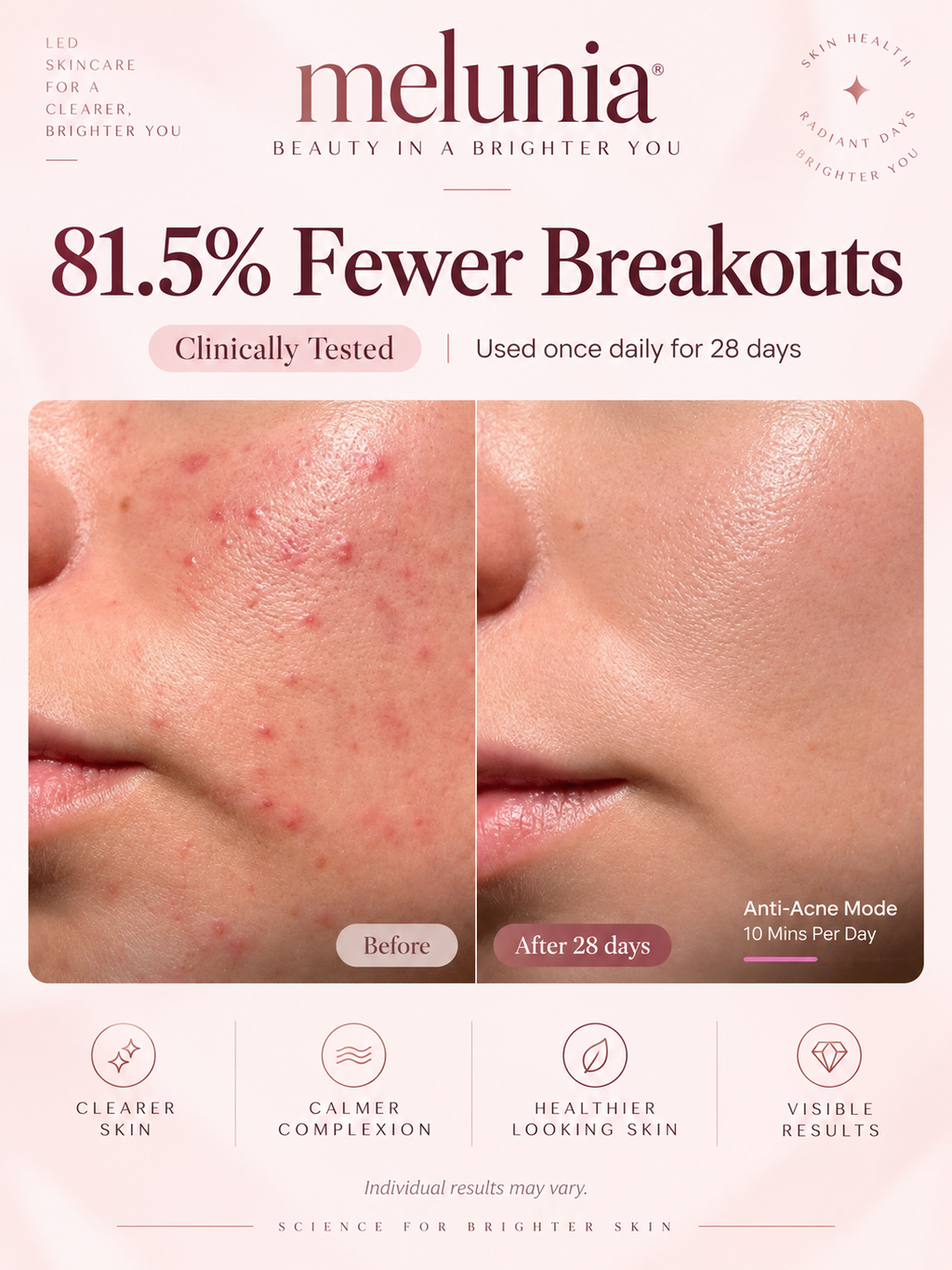 Melunia LED Facial Therapy Mask